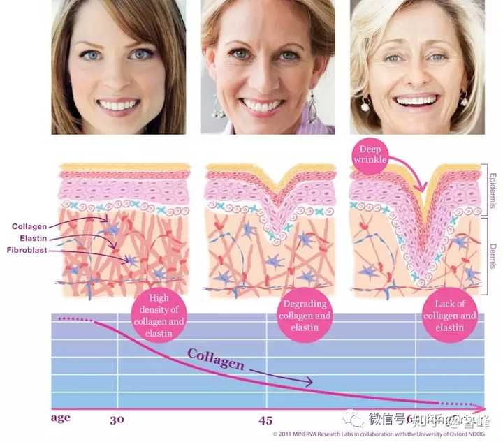 成纤维细胞的衰老直接导致胶原和弹力蛋白降解,致使皮肤的松垂,细纹