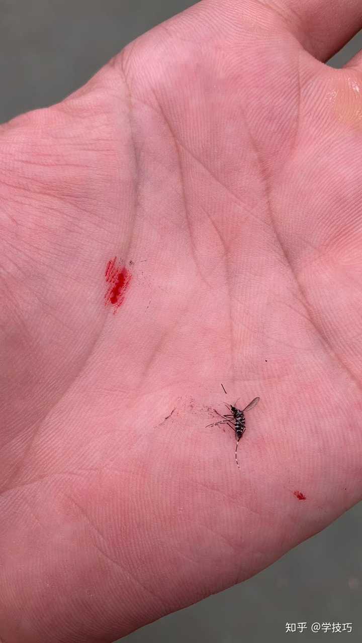 只切掉蚊子的全部腿,而不破坏蚊子其他身体部分,蚊子还能飞起来么?