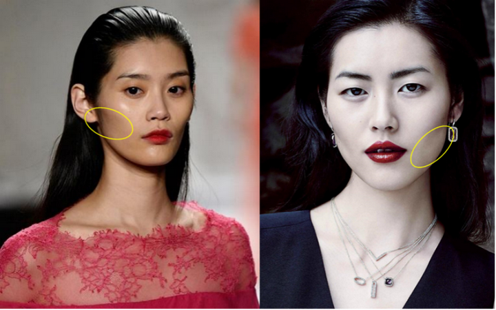 脸上颧骨高有什么办法改善(脸上颧骨高有什么办法改善吗)