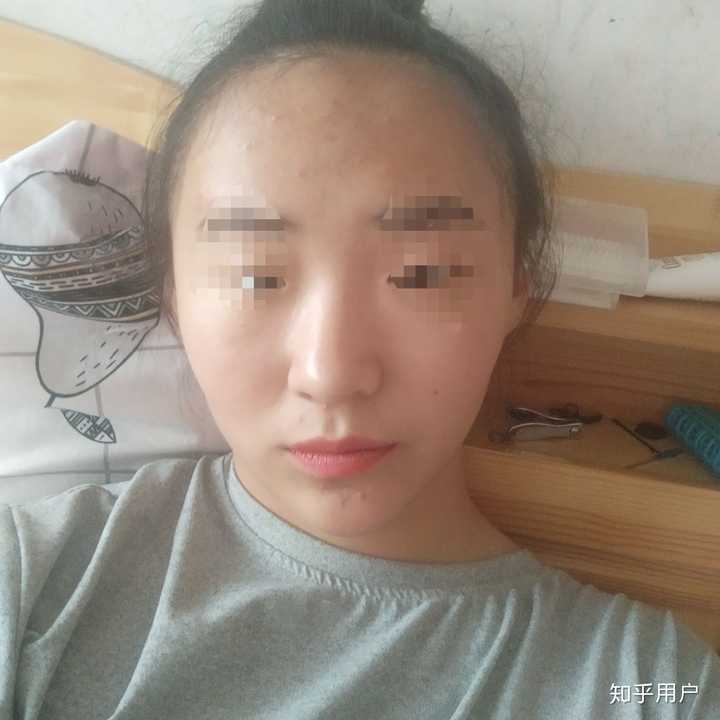 你再来看我后置拍的,不光鼻子歪,脸也歪.还不对称!