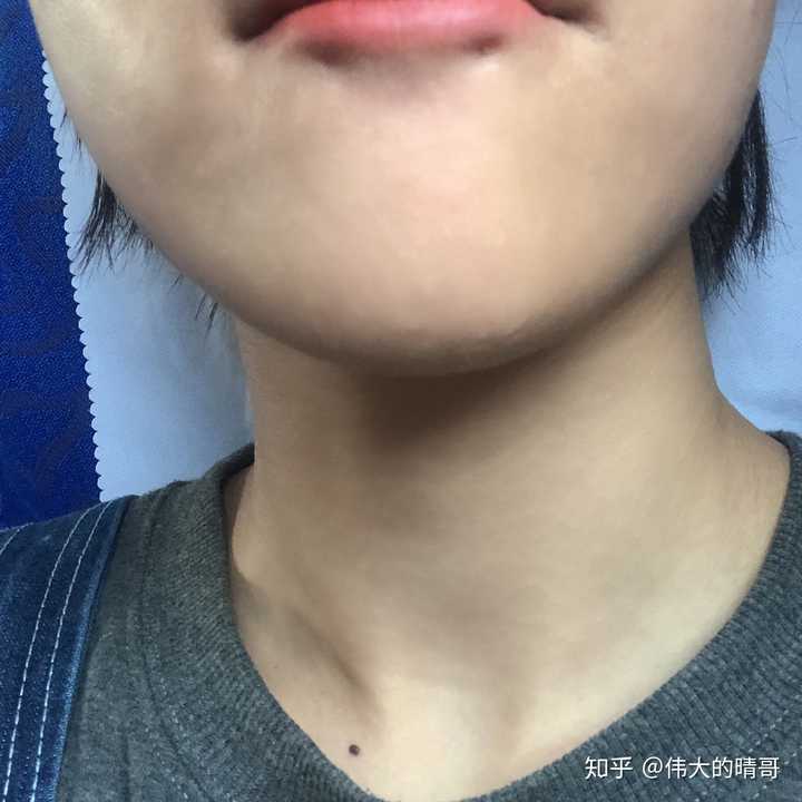 我想看看唇钉摘下后是什么样子的?