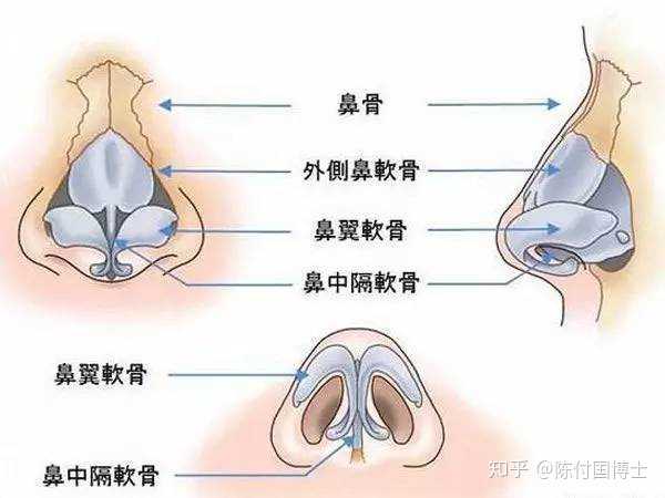 肋骨或者假体填充鼻基底好看吗,老了会怎么样?