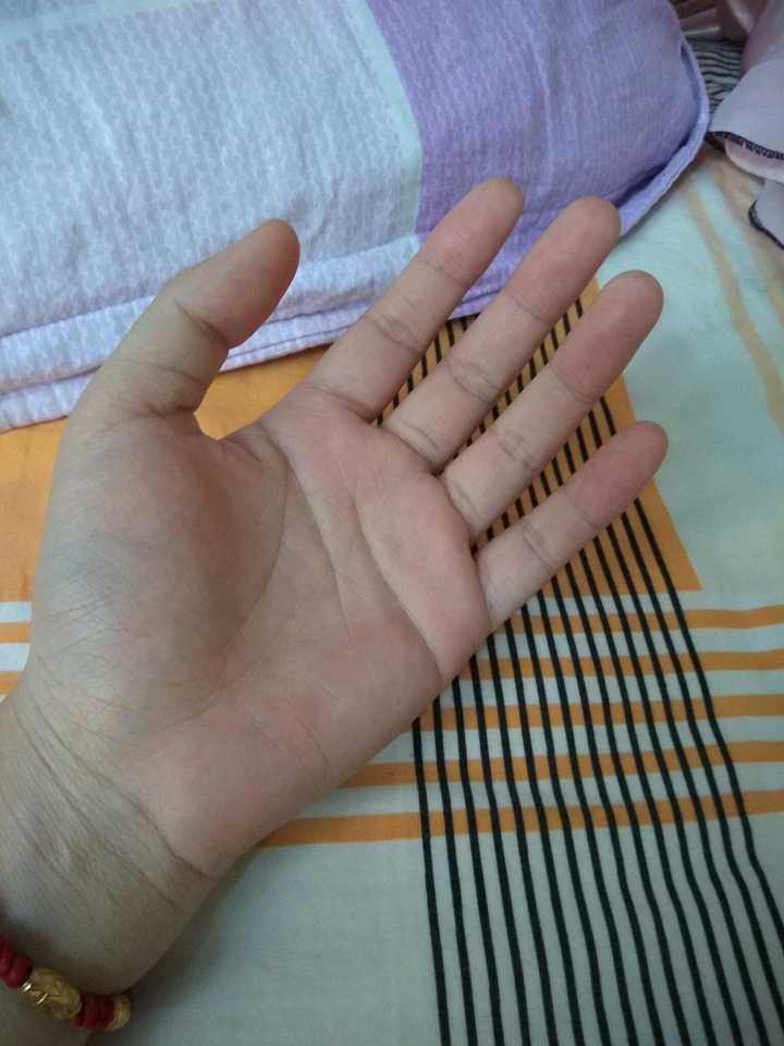 晒出你的小胖手,说出小胖手给你了哪些困扰?