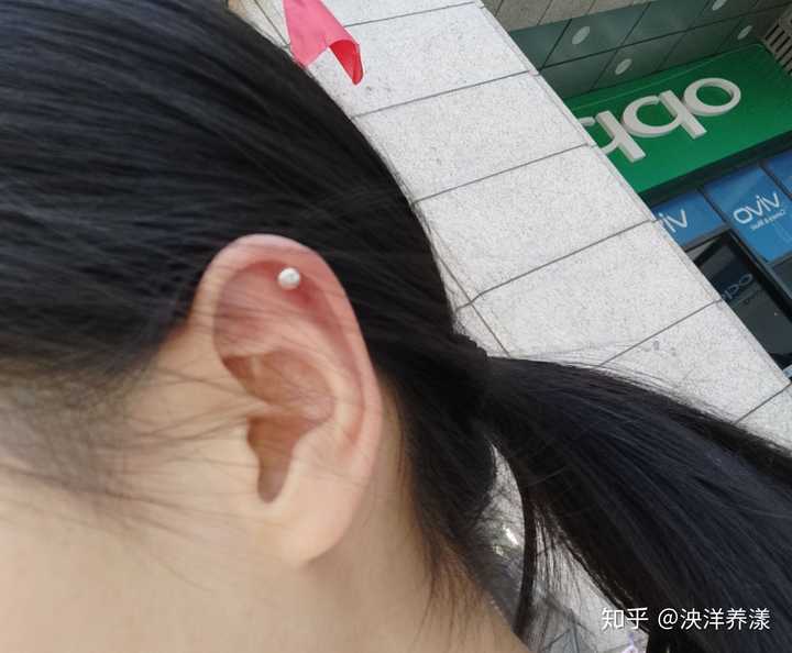 刚打完耳洞一周因为发现里面有脓所以摘下来消毒,结果戴进去完后发现