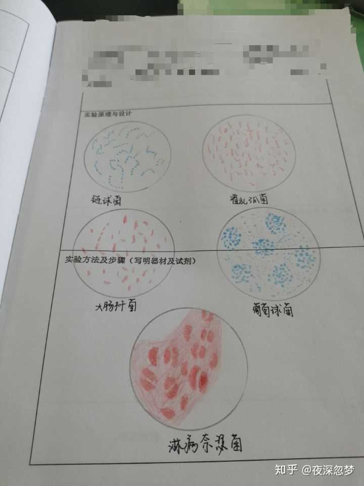 有医学解剖组胚基础实验课的手绘图吗,比如肝的脏面?