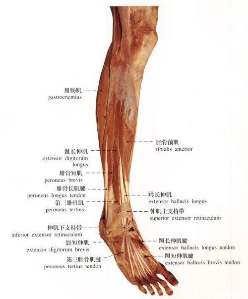 打篮球的时候,踩到别人的脚,崴脚,导致撕脱性骨折,不是很严重.