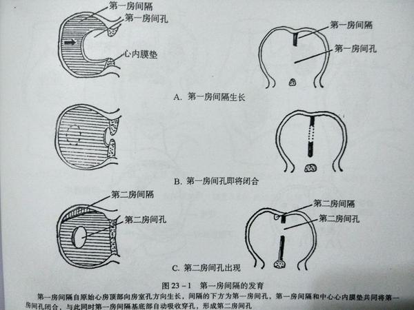 这我们就要从房间隔的发育说起来了.