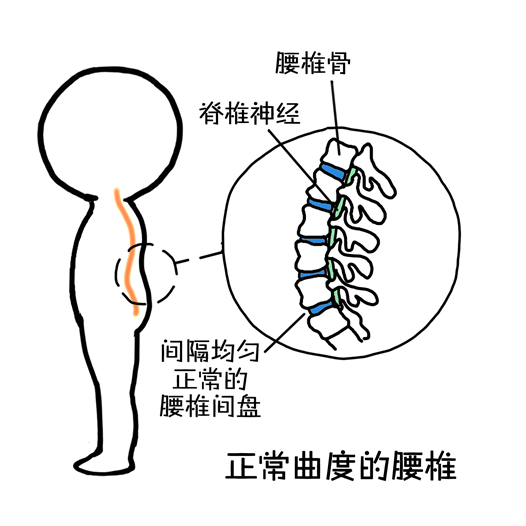 弯腰的姿势会破坏腰椎的生理曲度,让腰椎变直甚至反弓,从而对腰椎间盘