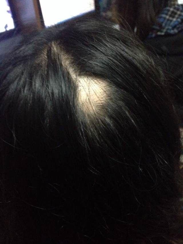 <em>熬夜</em>会<em>掉头发</em>吗? - 匿名用户的回答 - 知乎