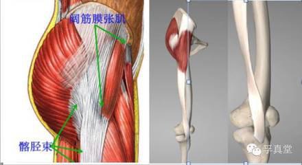 髌骨软化的正确处理方式