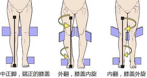 o型腿的形成原因是膝盖内旋