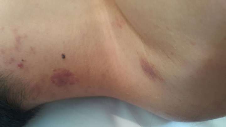 如果把自己喜欢的男生扑倒在脖子上种草莓,会怎么样啊