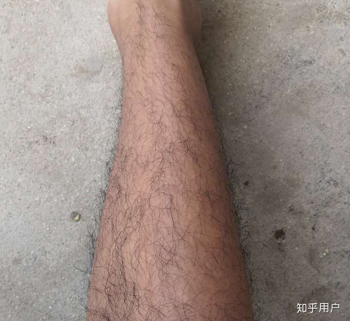 男生体毛旺盛是一种什么样的体验?