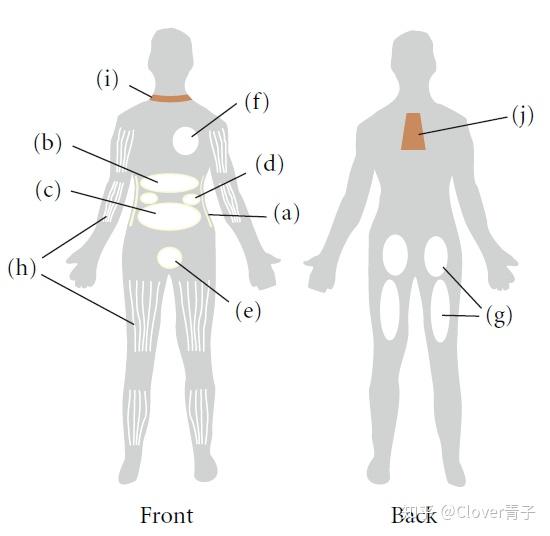 脂肪在人体内的分布,示白色脂肪和棕色脂肪