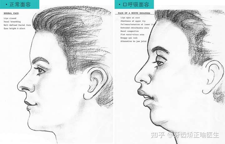 用鼻子和用嘴呼吸对脸型真的有影响么?
