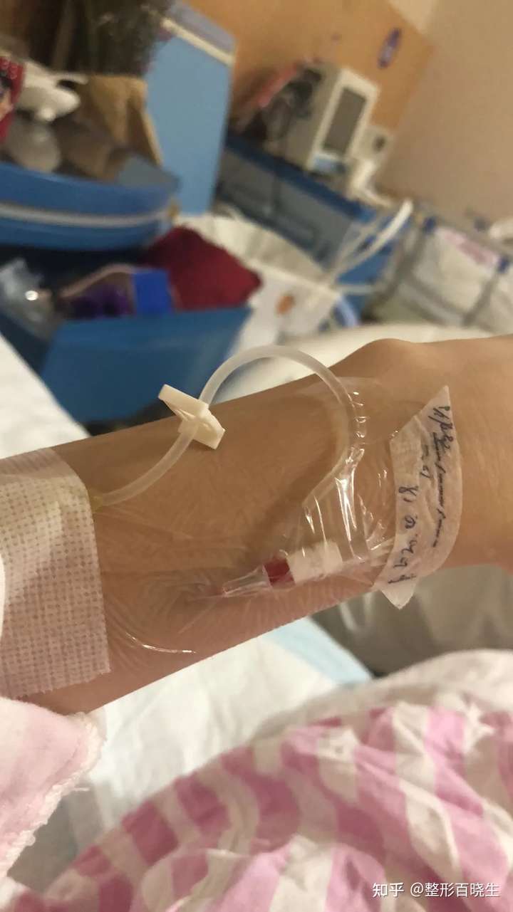 做了大腿吸脂的美美们,你们都后悔了吗?