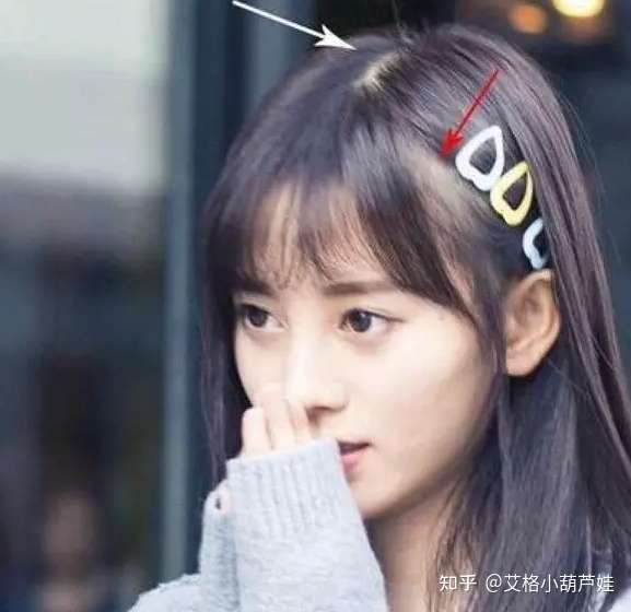 请问女孩子散开头发头顶是这样的算秃吗