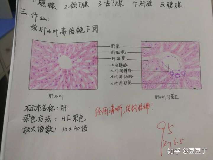 高倍镜下肝小叶和门管区红蓝铅笔手绘图?