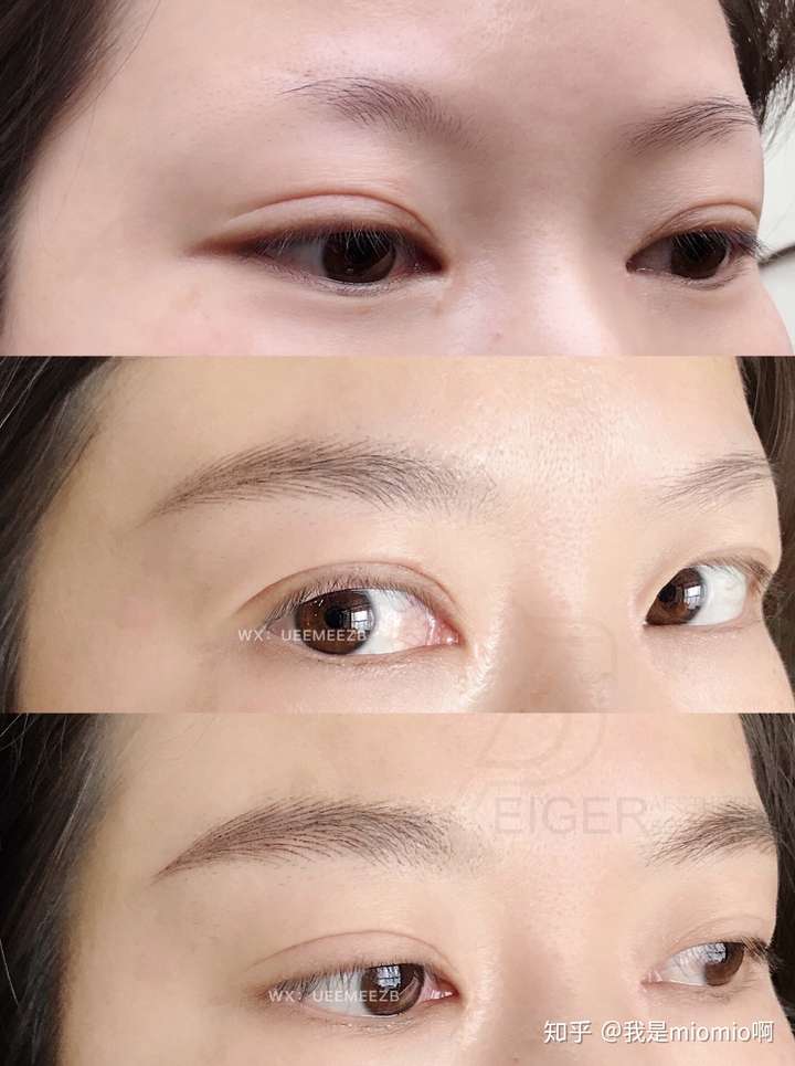 眉毛只有半截.用了数十种增长液都没有效果 怎么办?