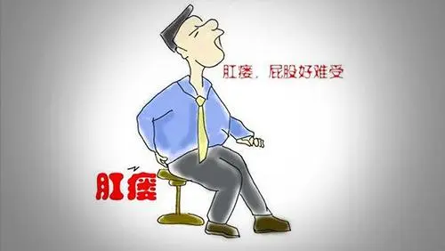 肛瘘是什么症状表现?