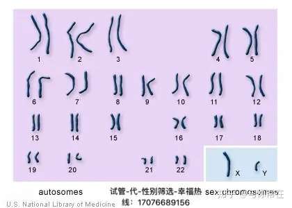 性染色体异常如xxyxyy型对个人的影响是什么特纳氏综合征