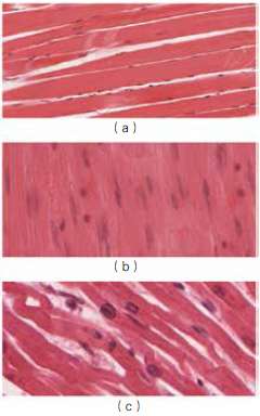 肌肉有三种,骨骼肌(a),平滑肌(b)和心肌(c),和运动能力有关的是骨骼