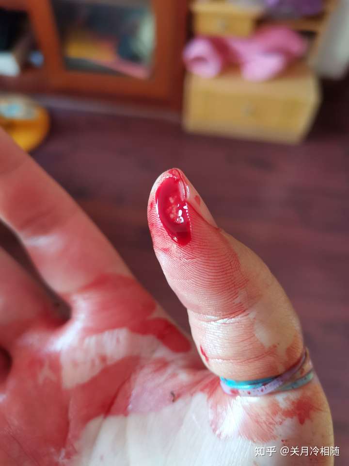 手指被切下一块肉多长时间能恢复