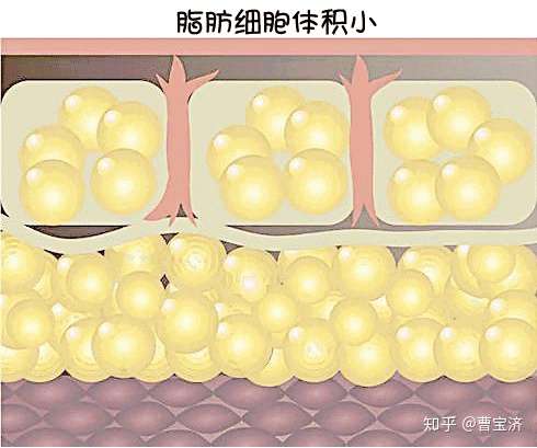 眼袋的形成主要是由于眶周支持结构松弛以及眶隔脂肪颗粒膨大造成的.