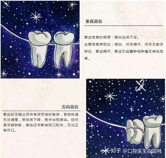 看看这些拔智齿的收费依据,你就知道为什么有的人只要