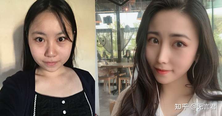 天津有哪些好一点的整容医院,最好是鼻部的?