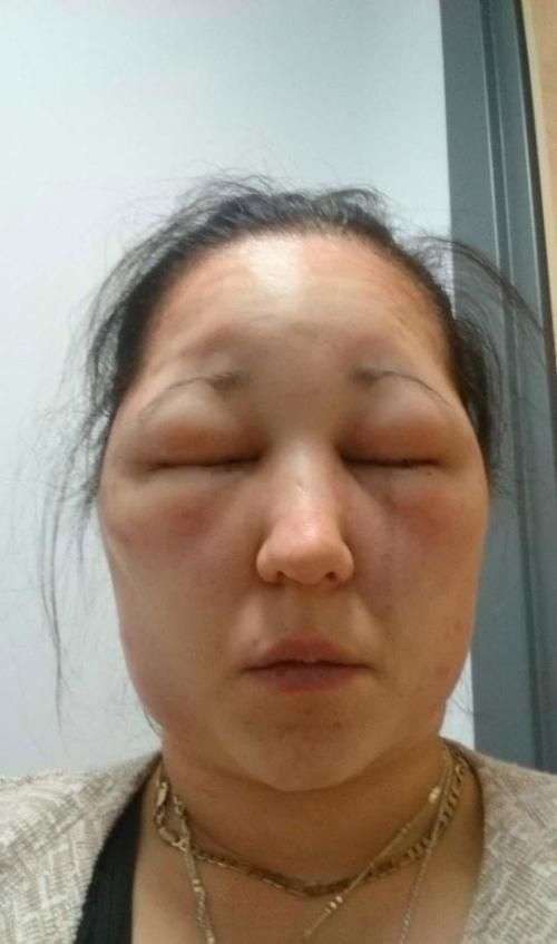 颜面受损