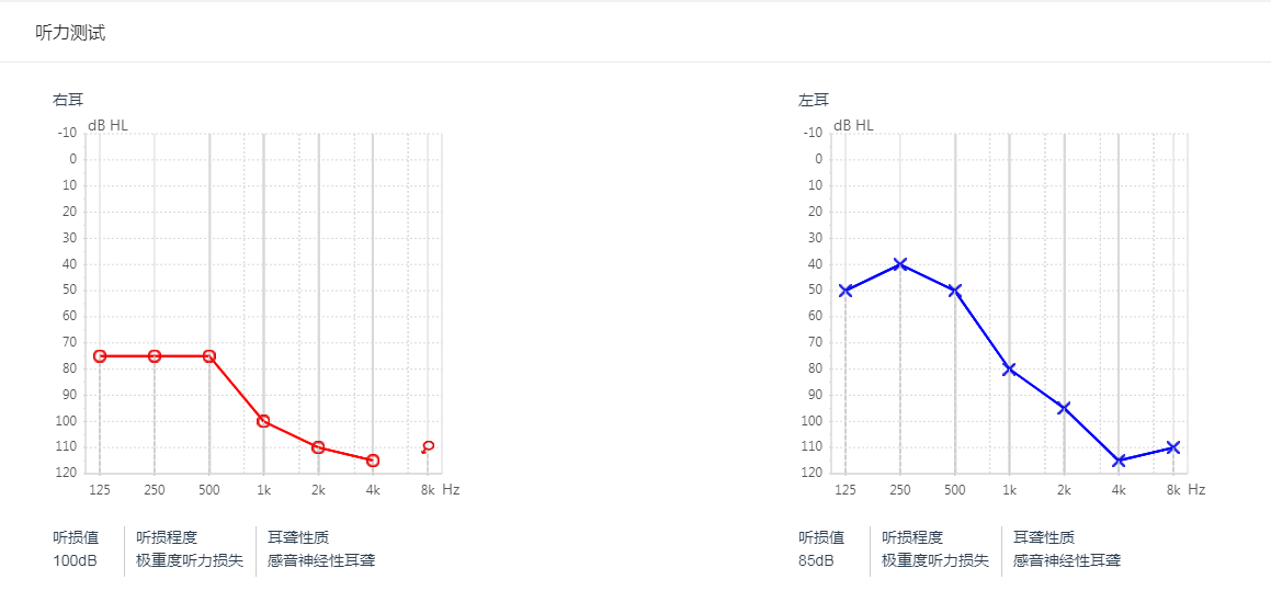 听力残疾人要不要上大学?