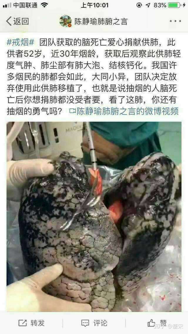 十八年烟龄戒烟还有希望吗?能改善肺部吗?