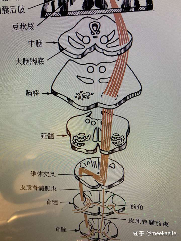 书上原话是:皮质脊髓束在延髓交叉以上水平受损,可导致损伤对侧上