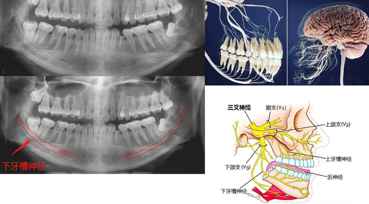 牙齿的神经连接到何处?