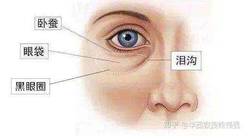 怎么区分黑眼圈和眼袋?