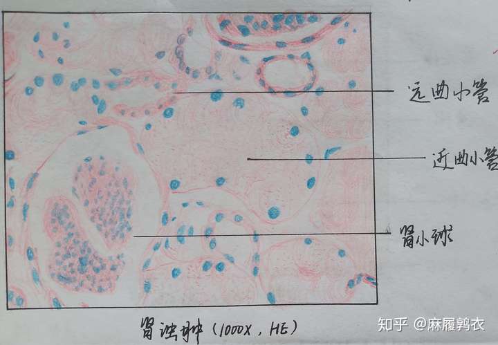 为什么咱们不弄个病理红蓝手绘图的问题呢?