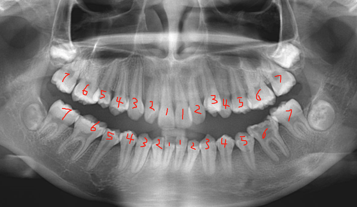 正常人有多少颗牙齿呀?