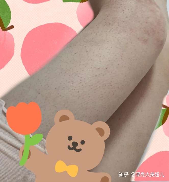 有没有去鸡皮的好方法?