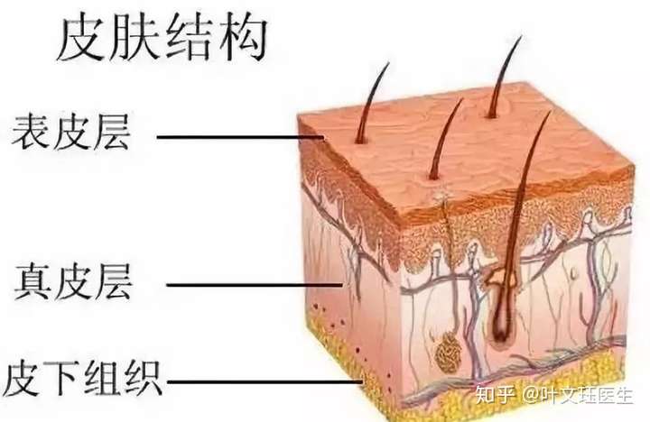 简单来讲 皮肤有三层主要结构: 表皮,真皮和皮下组织.
