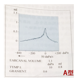 中耳功能正常的鼓室导抗图