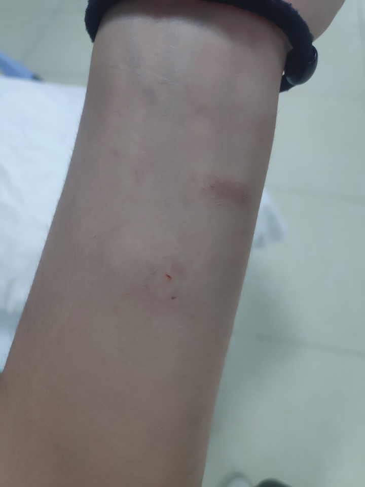 为什么皮试这么痛!