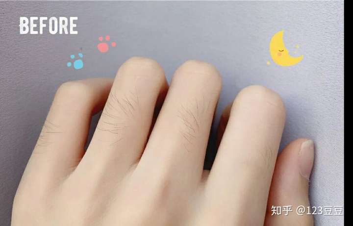 有没有什么好的脱毛方法?