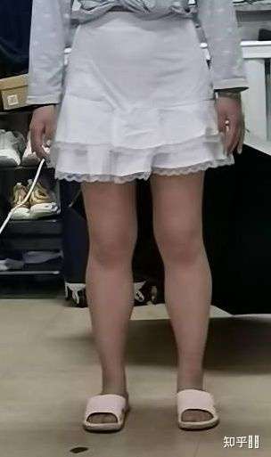 如何看待腿粗的女孩子穿短裙
