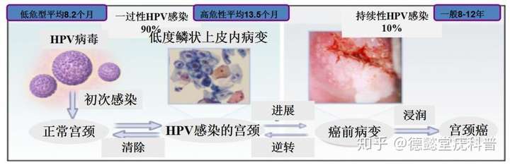 检查出hpv病毒感染也就是hpv阳性,这并不等同于就是宫颈癌!