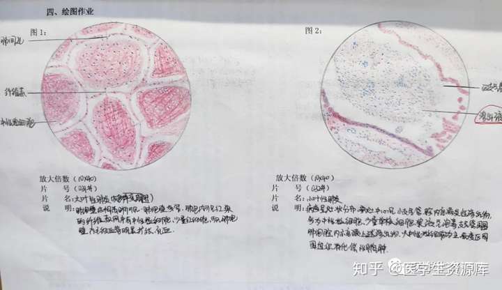 病理切片红蓝铅笔手绘图