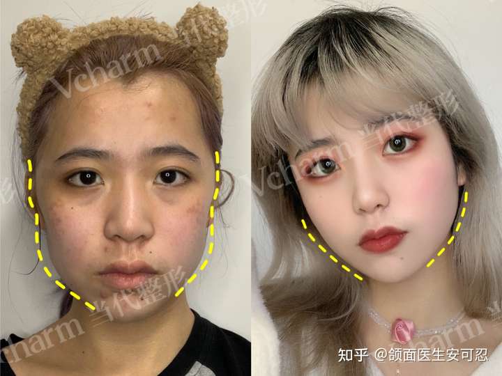 有大小脸,怎么办?