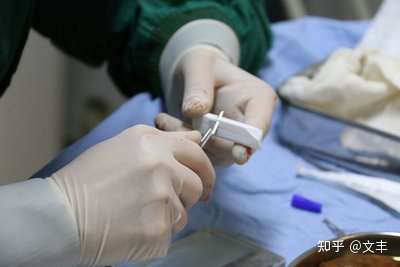 舒铂鼻子可以做的精致吗