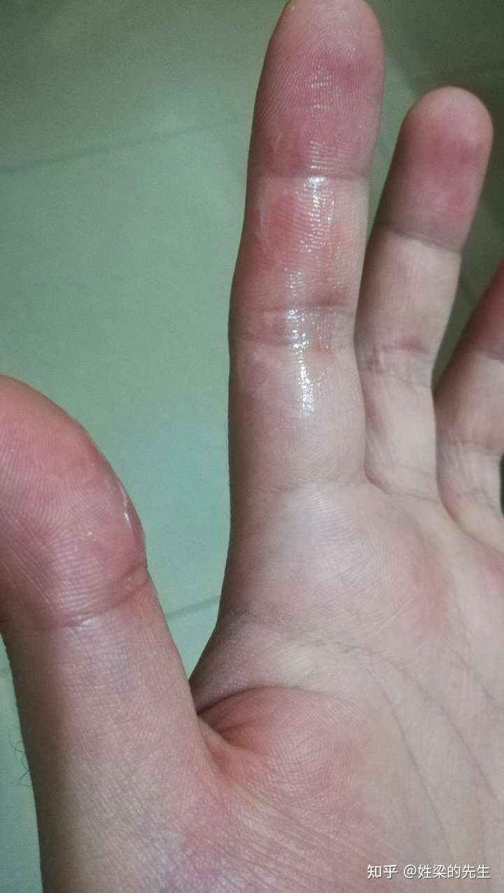 被烧的通红的烙铁烫是什么体验?