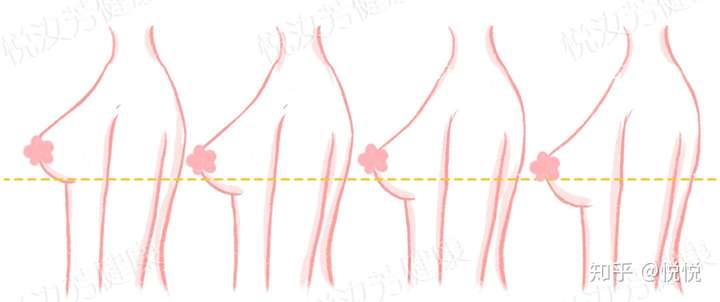 胸型史上最全胸型科普合集拿走不谢